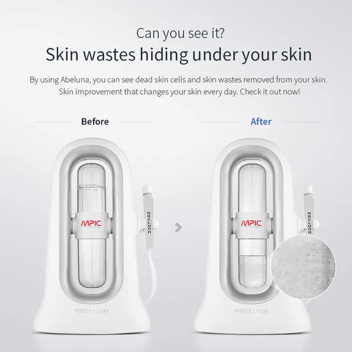 جهاز تقشير - Abeluna aqua peeling device