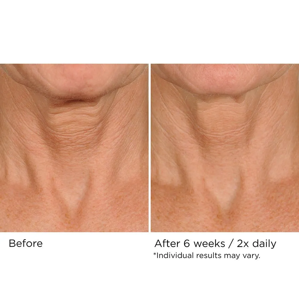 Deco-Lift Neck & Decollete Firming & Lifting Complex 4 oz