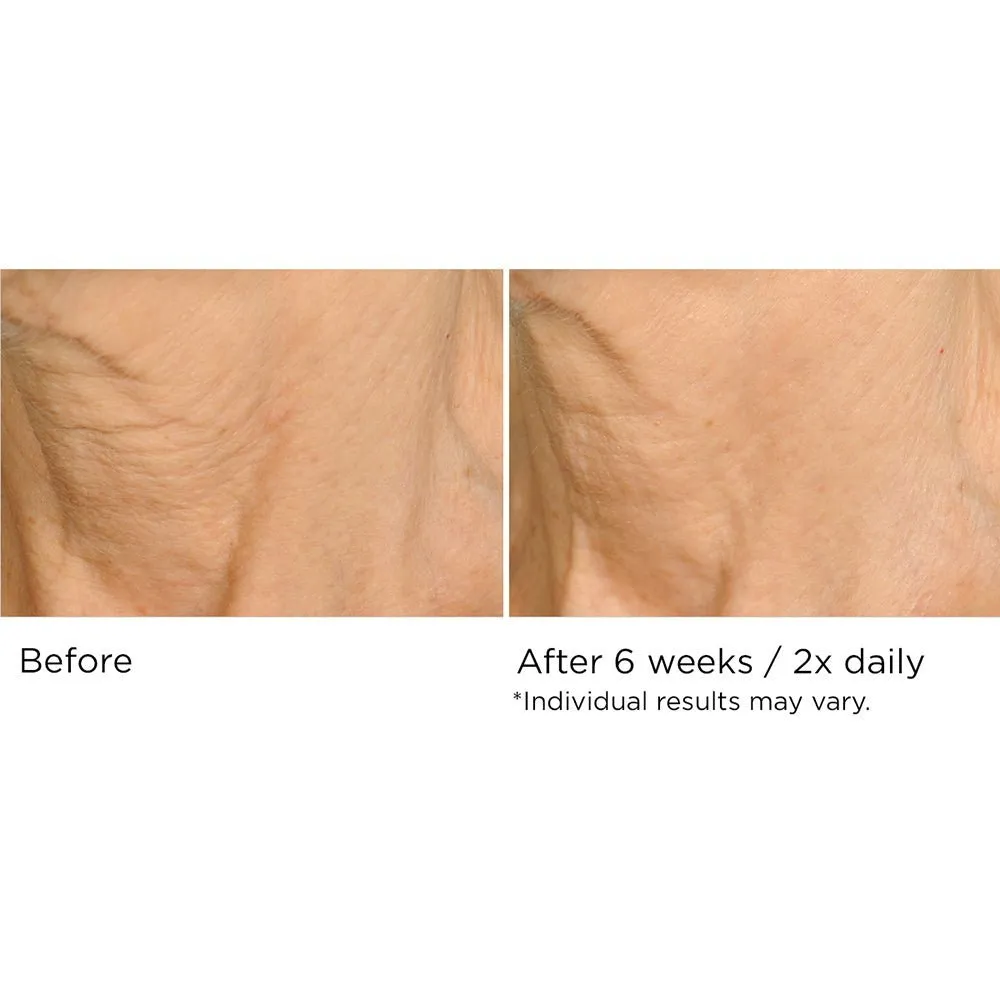 Deco-Lift Neck & Decollete Firming & Lifting Complex 4 oz